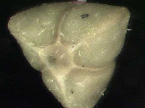 Fruit