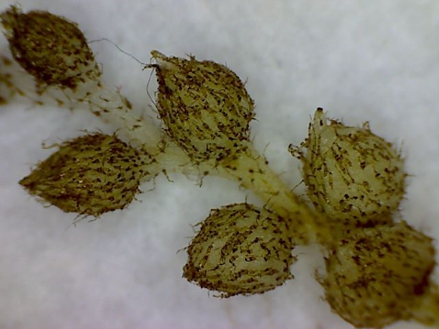 A chain of scaley ovoid structures.