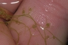 Close-up macro of a hand cradling the bladder traps.